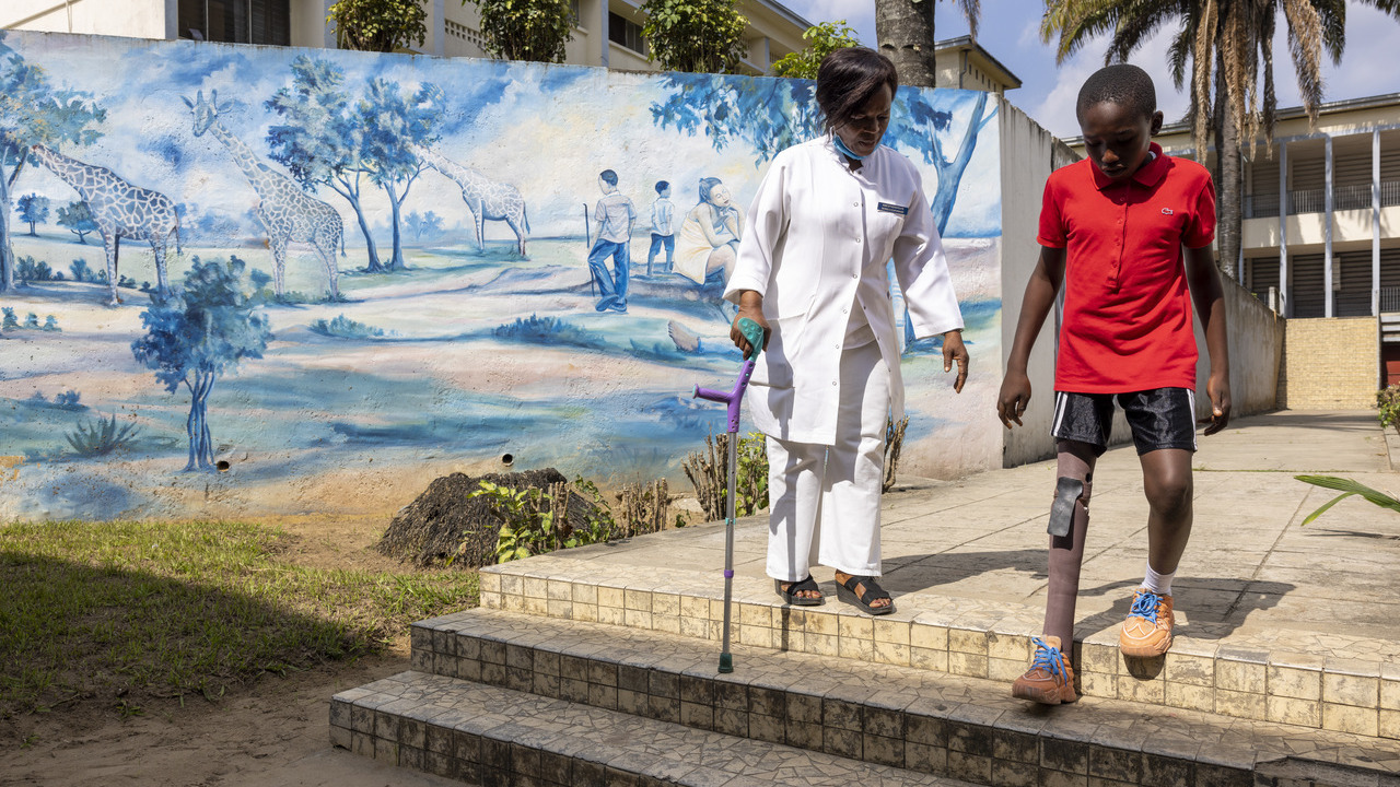  In 2022, thanks to the support of HI, Dieudonné obtained a prosthesis and is currently undergoing rehabilitation at the Cliniques Universitaires de Kinshasa. 